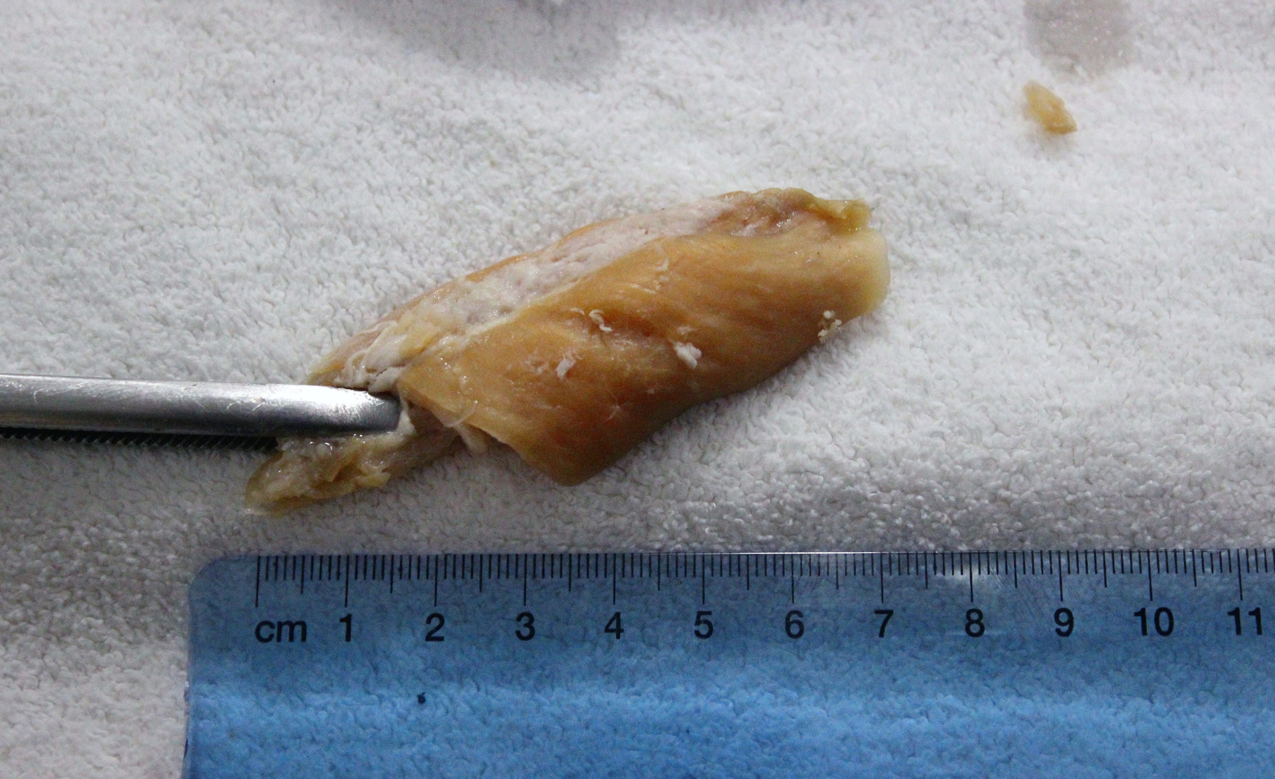 Chicken treat removed from dog's throat